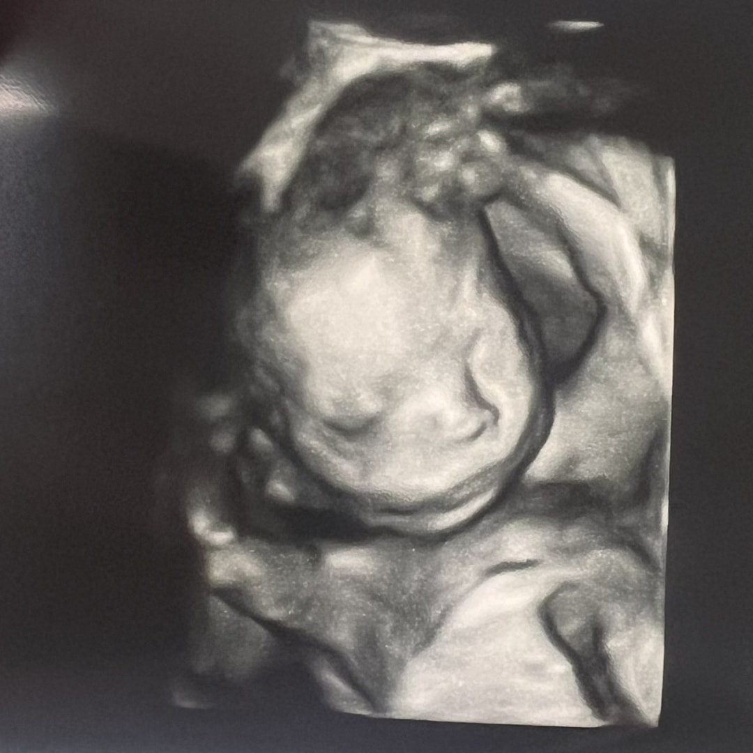 Photo shared by Nancy for their Babylist baby registry.