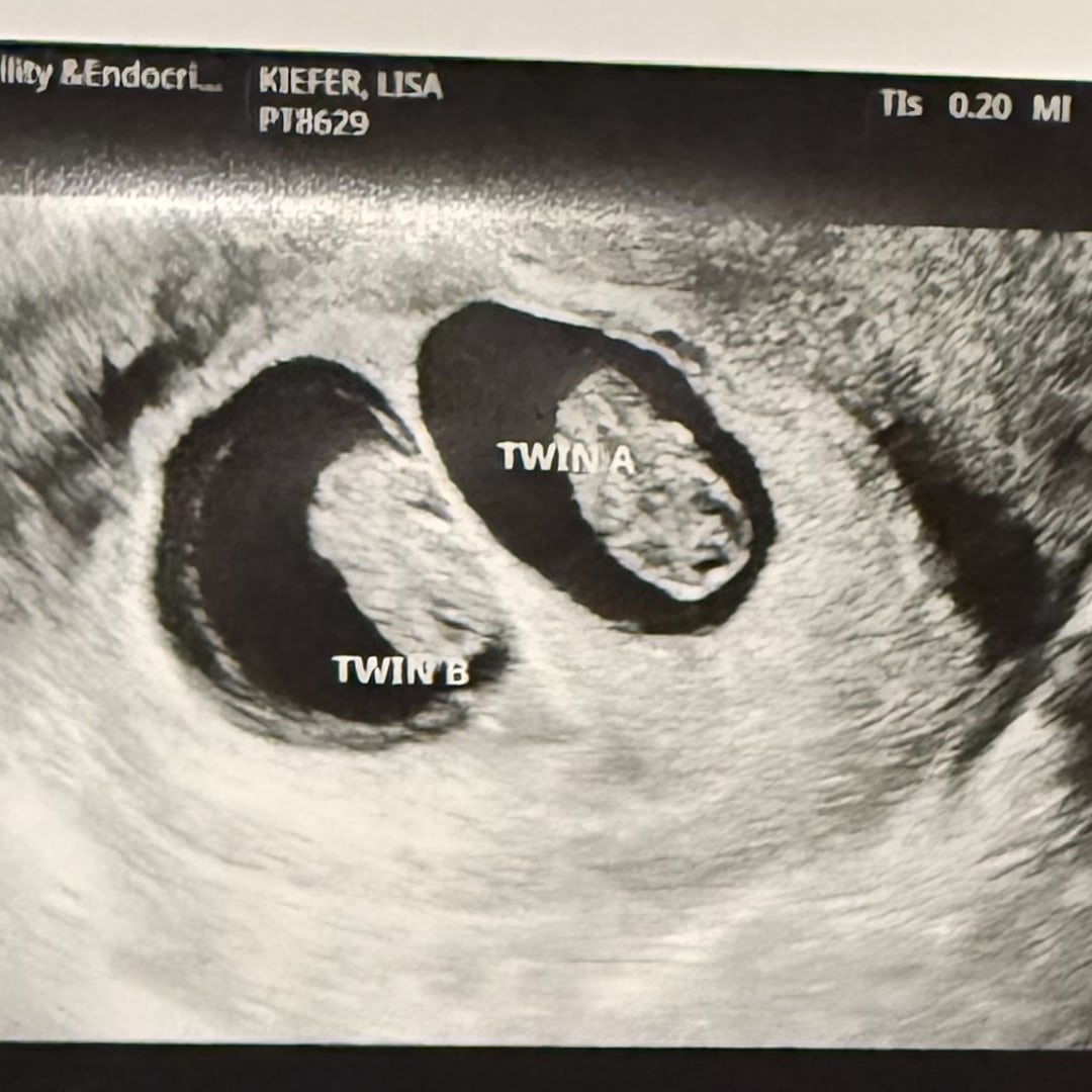 Photo shared by Nikki for their Babylist baby registry.