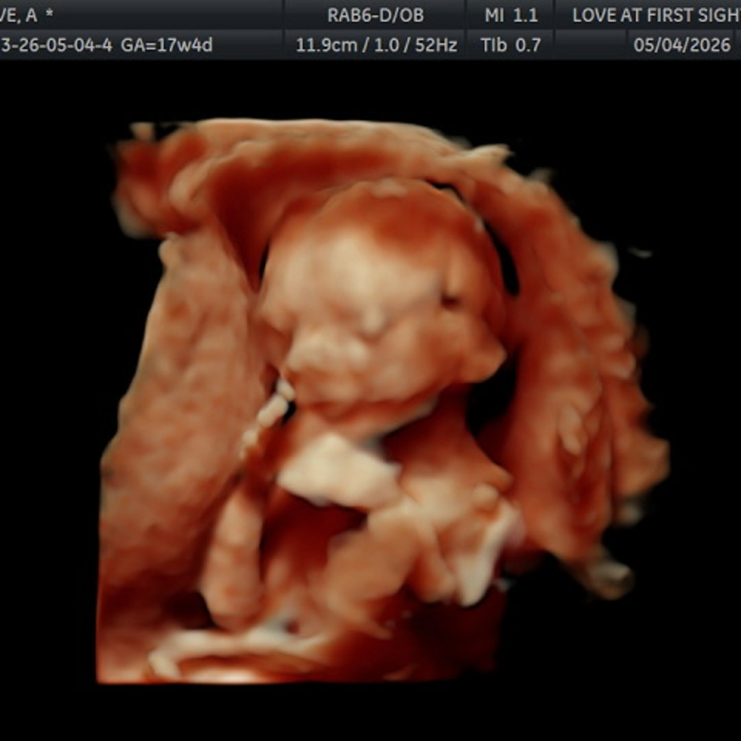 Photo shared by Alyssa for their Babylist baby registry.