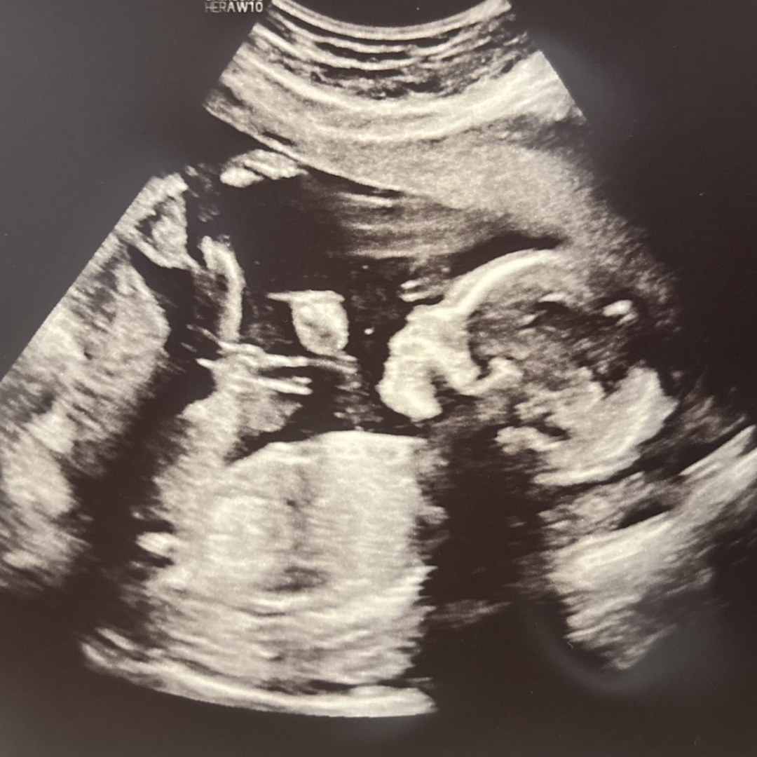 Photo shared by Crystal for their Babylist baby registry.