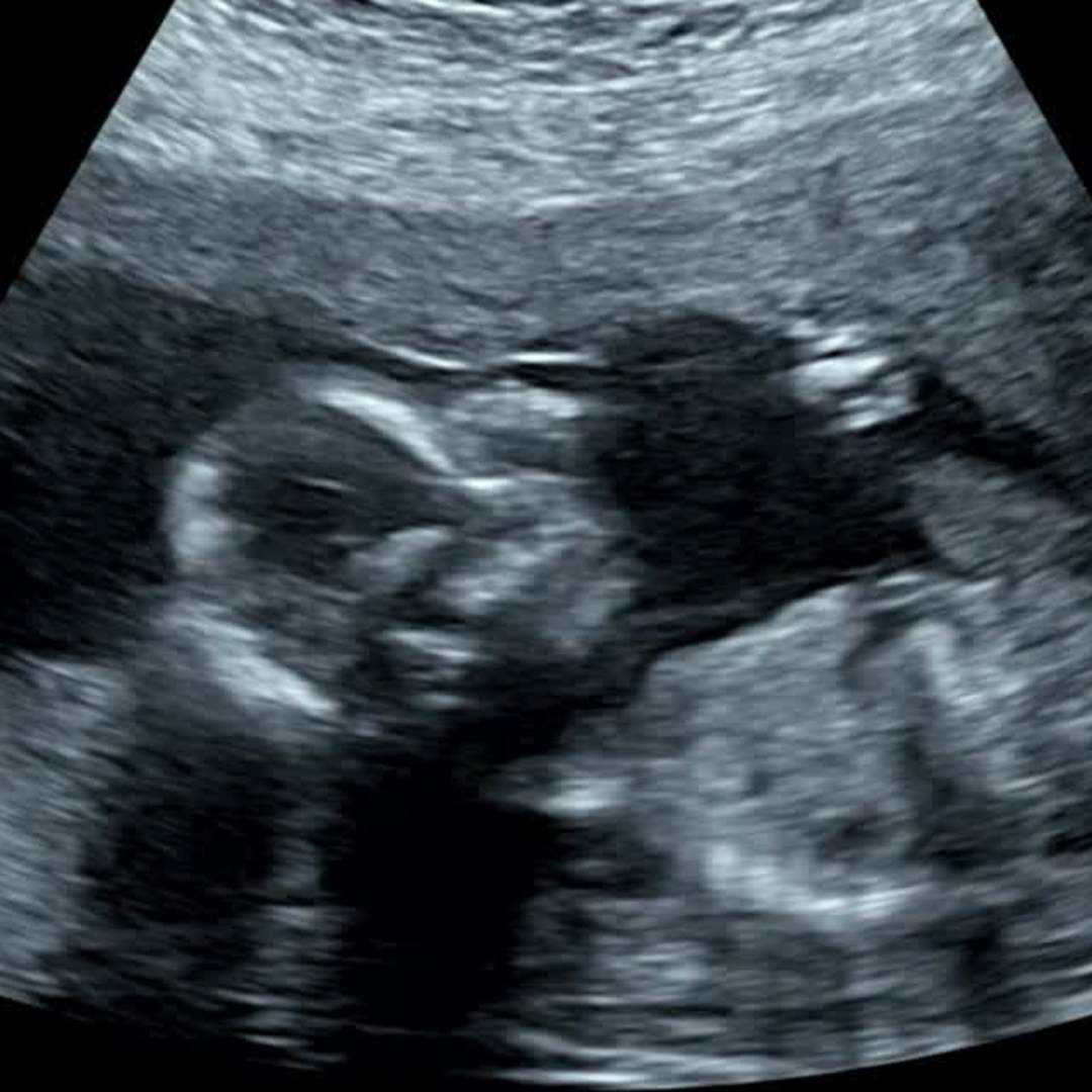 Photo shared by Ashley for their Babylist baby registry.