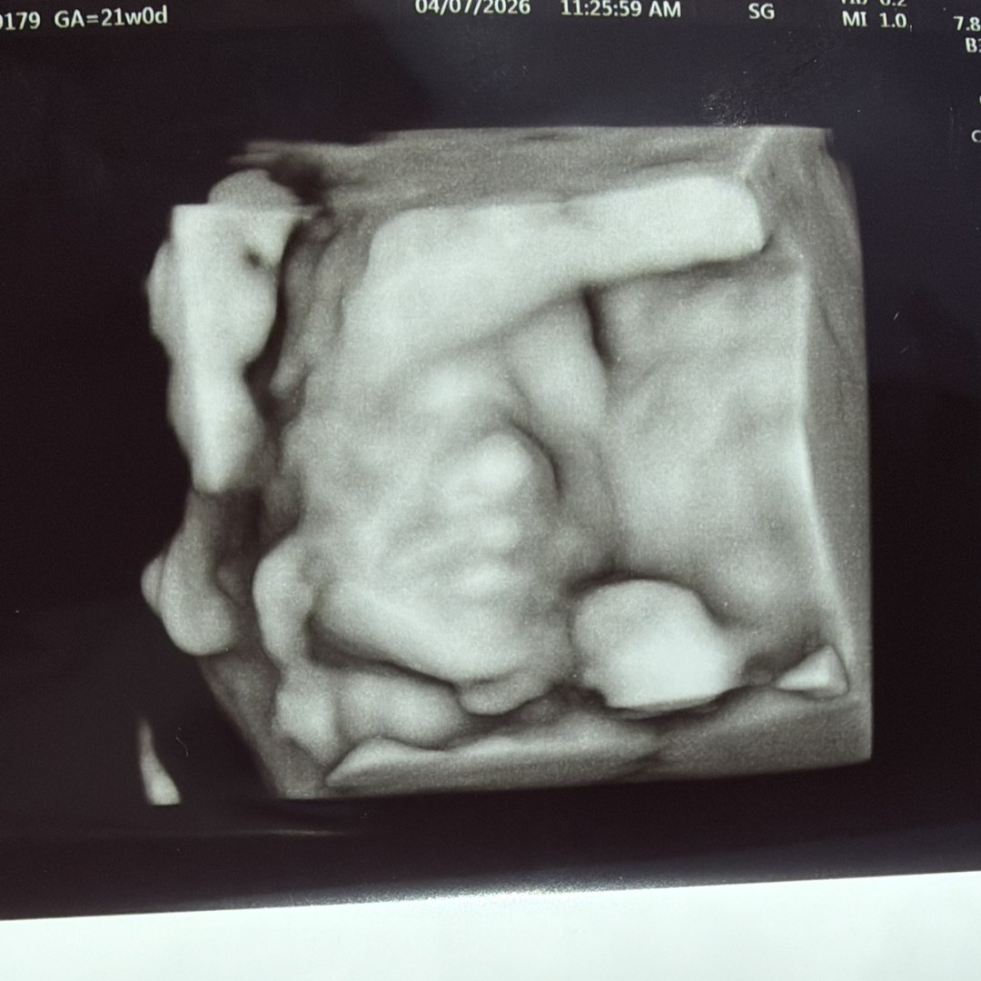 Photo shared by Catera for their Babylist baby registry.
