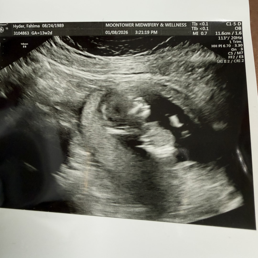 Photo shared by Ema for their Babylist baby registry.