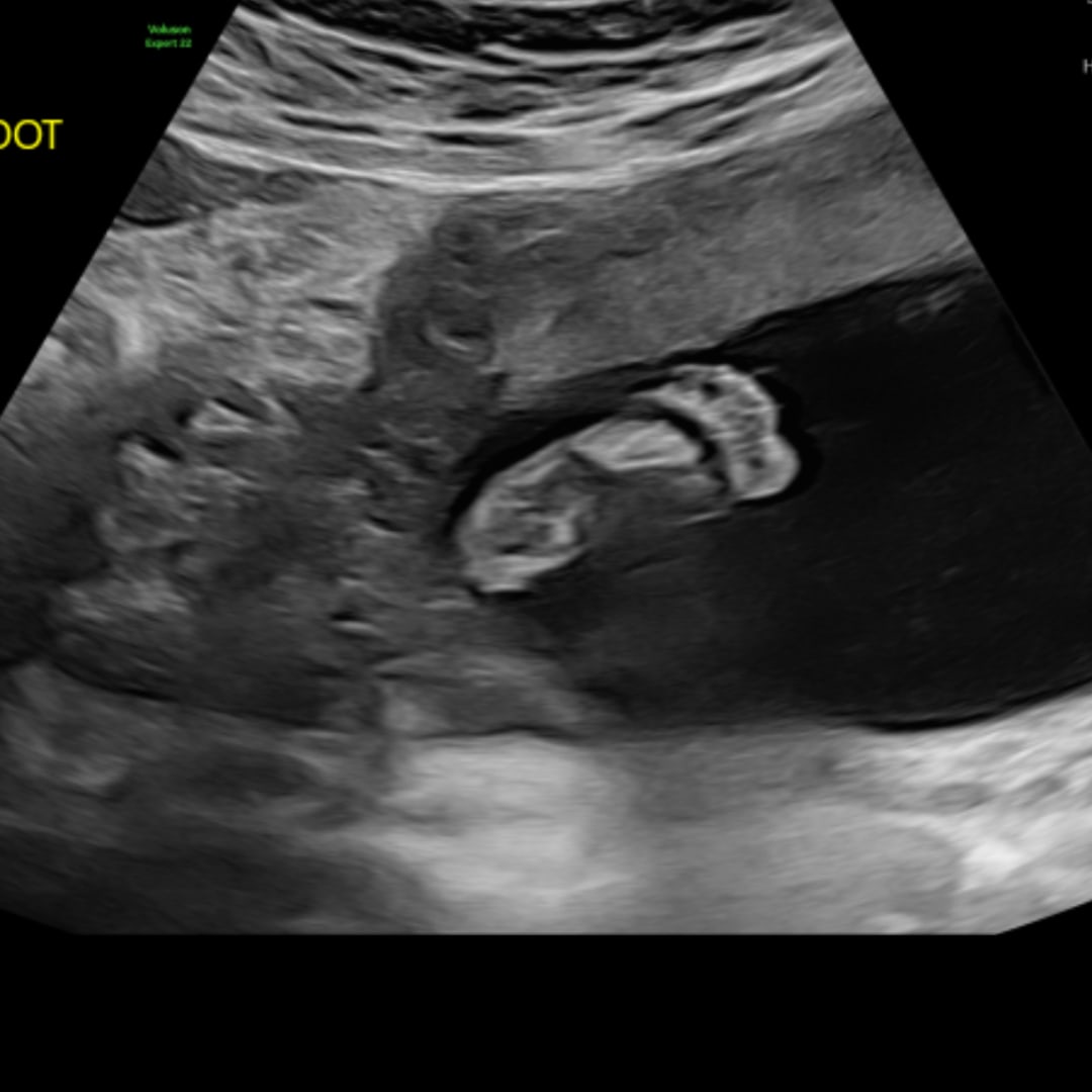 Photo shared by Christiano for their Babylist baby registry.