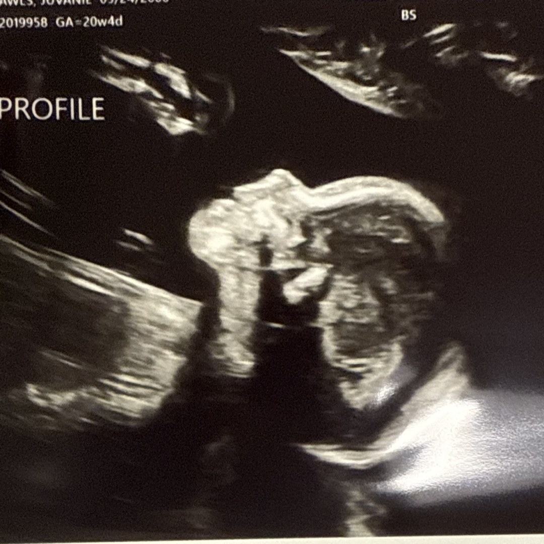 Photo shared by Juvi for their Babylist baby registry.