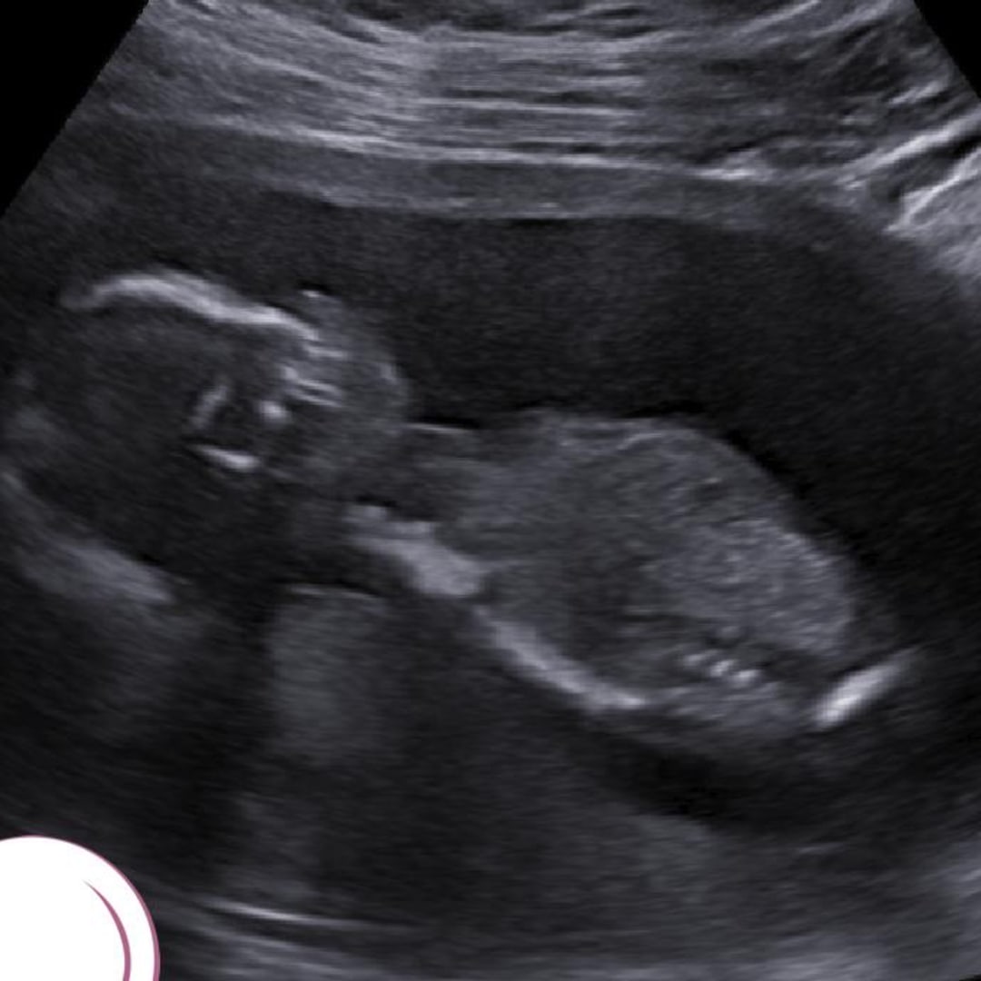 Photo shared by Sarah for their Babylist baby registry.