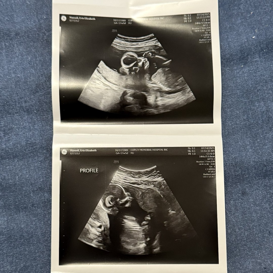 Photo shared by Erin for their Babylist baby registry.