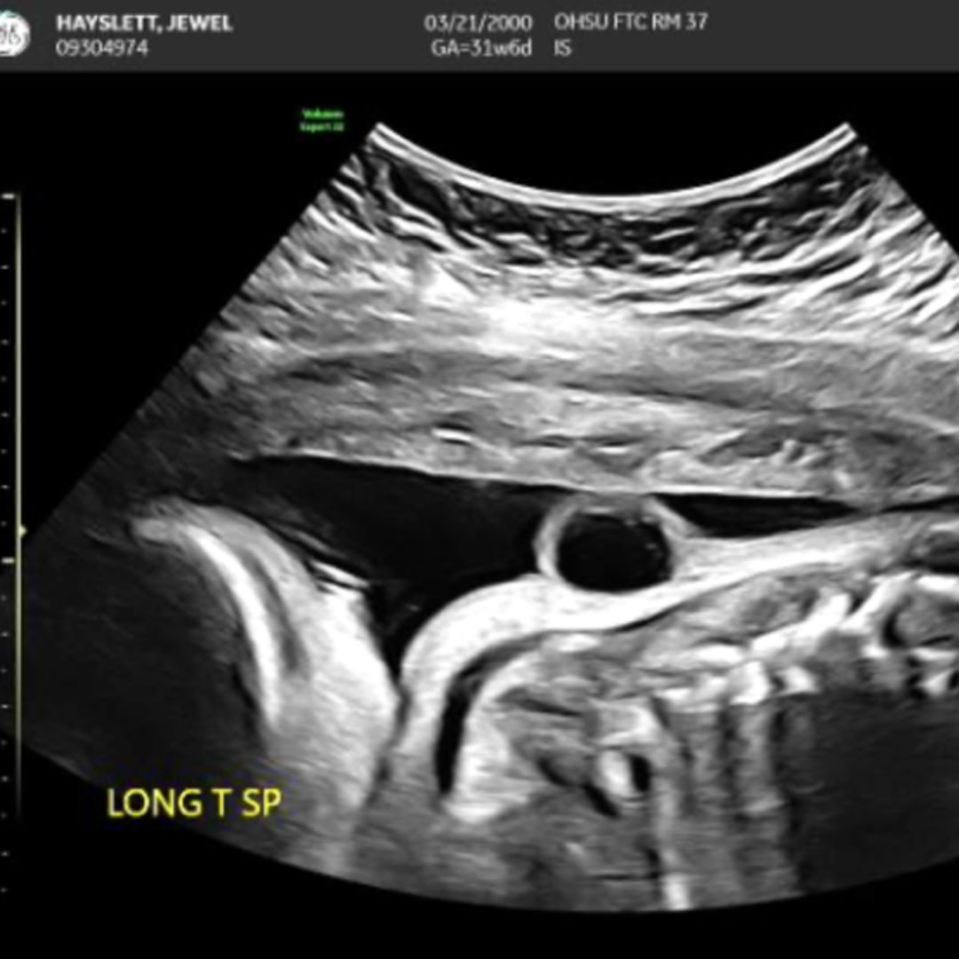 Photo shared by Jewel for their Babylist baby registry.