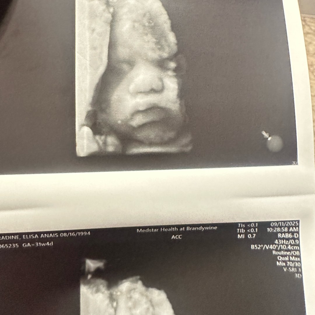 Photo shared by Elisa for their Babylist baby registry.