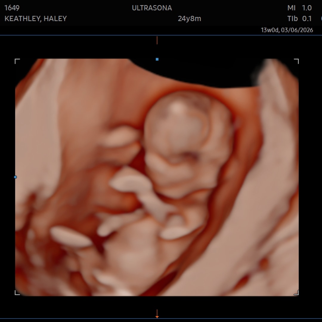 Photo shared by Haley for their Babylist baby registry.