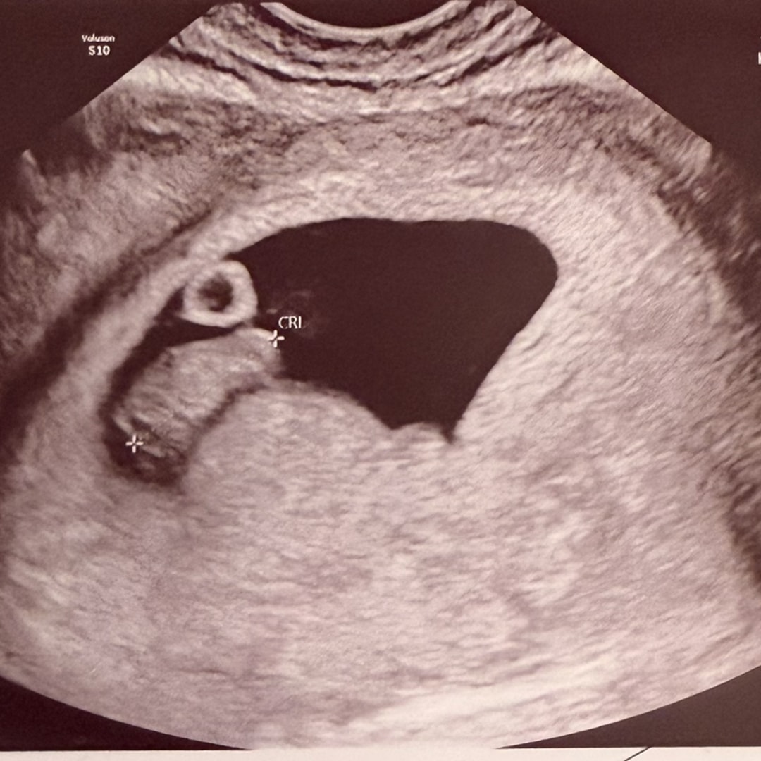 Photo shared by Deztiny for their Babylist baby registry.