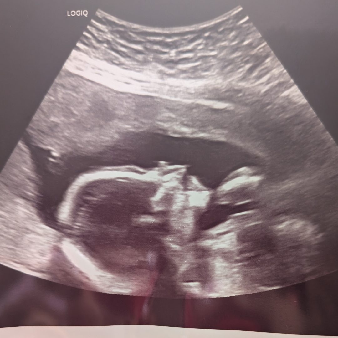 Photo shared by Geneen for their Babylist baby registry.