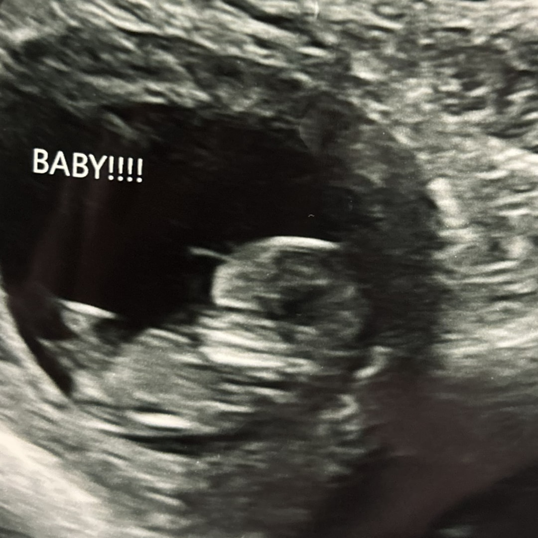 Photo shared by Jasmine for their Babylist baby registry.