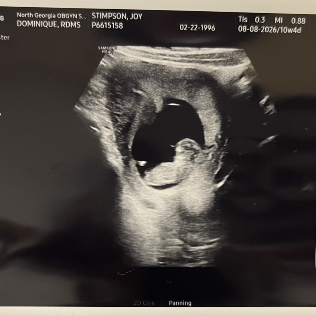 Photo shared by Joy for their Babylist baby registry.