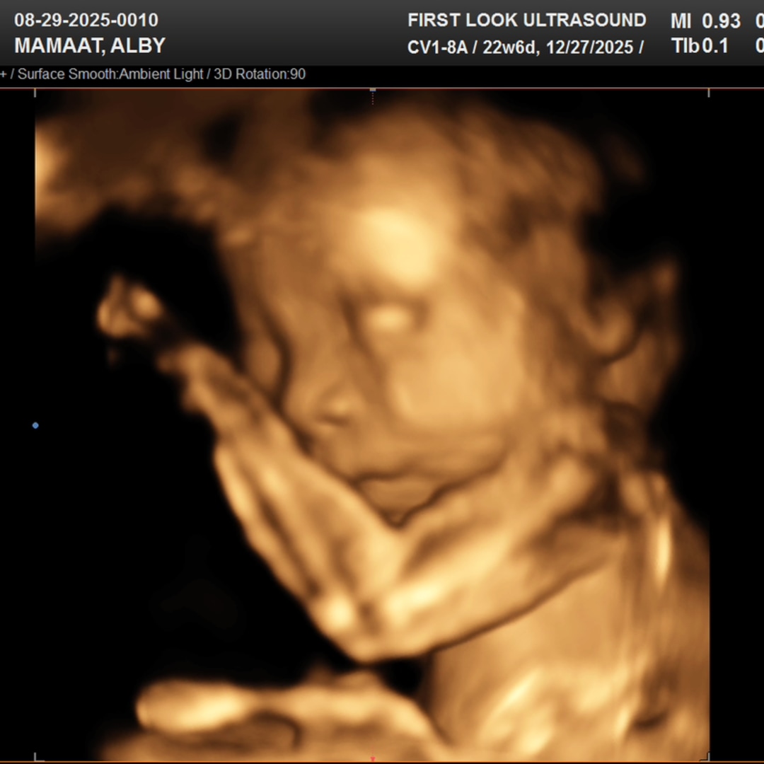 Photo shared by Alby for their Babylist baby registry.