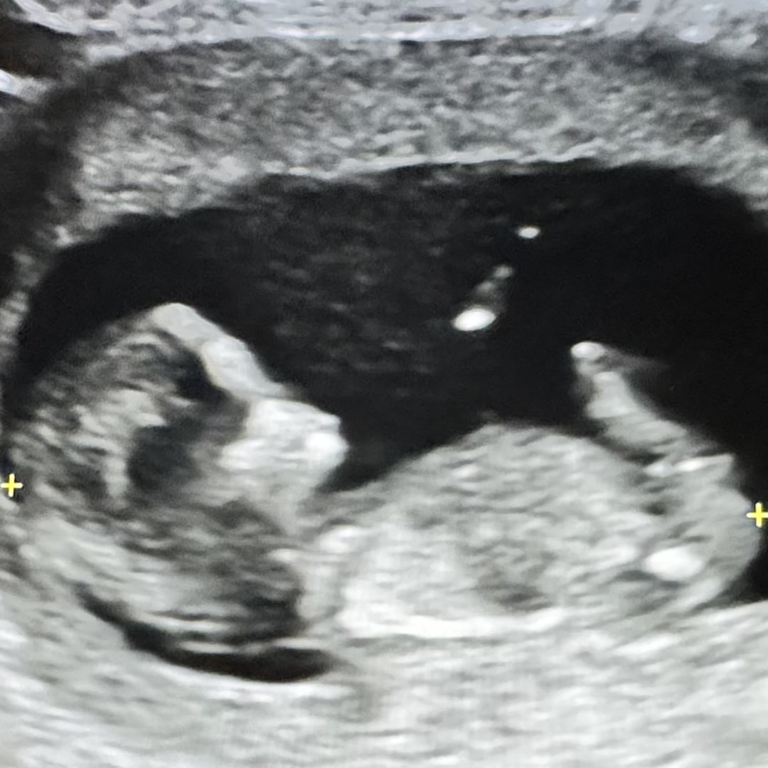 Photo shared by Rhiannon for their Babylist baby registry.