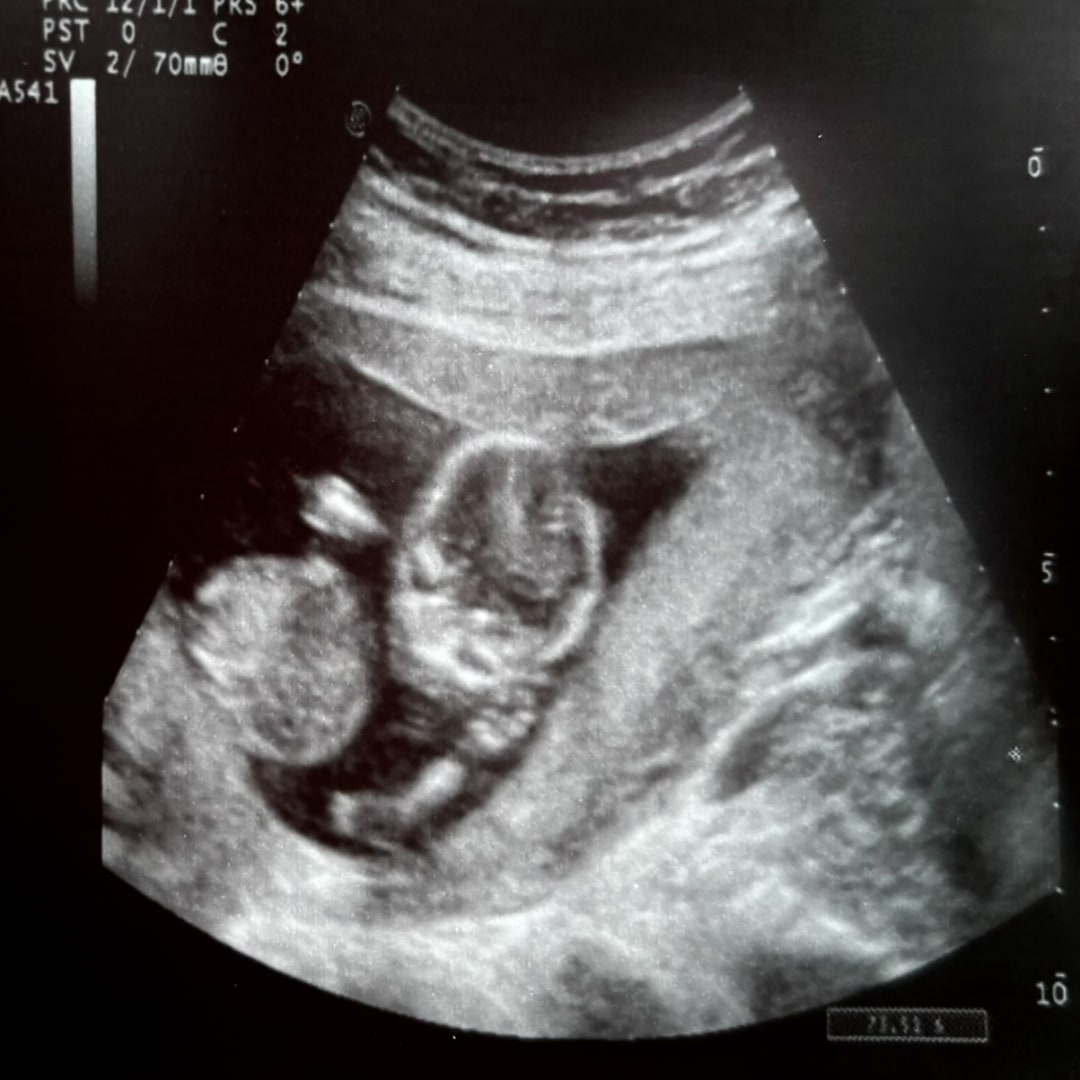 Photo shared by Riley for their Babylist baby registry.