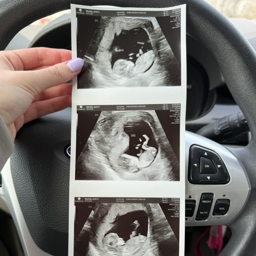 Photo shared by Jacey for their Babylist baby registry.
