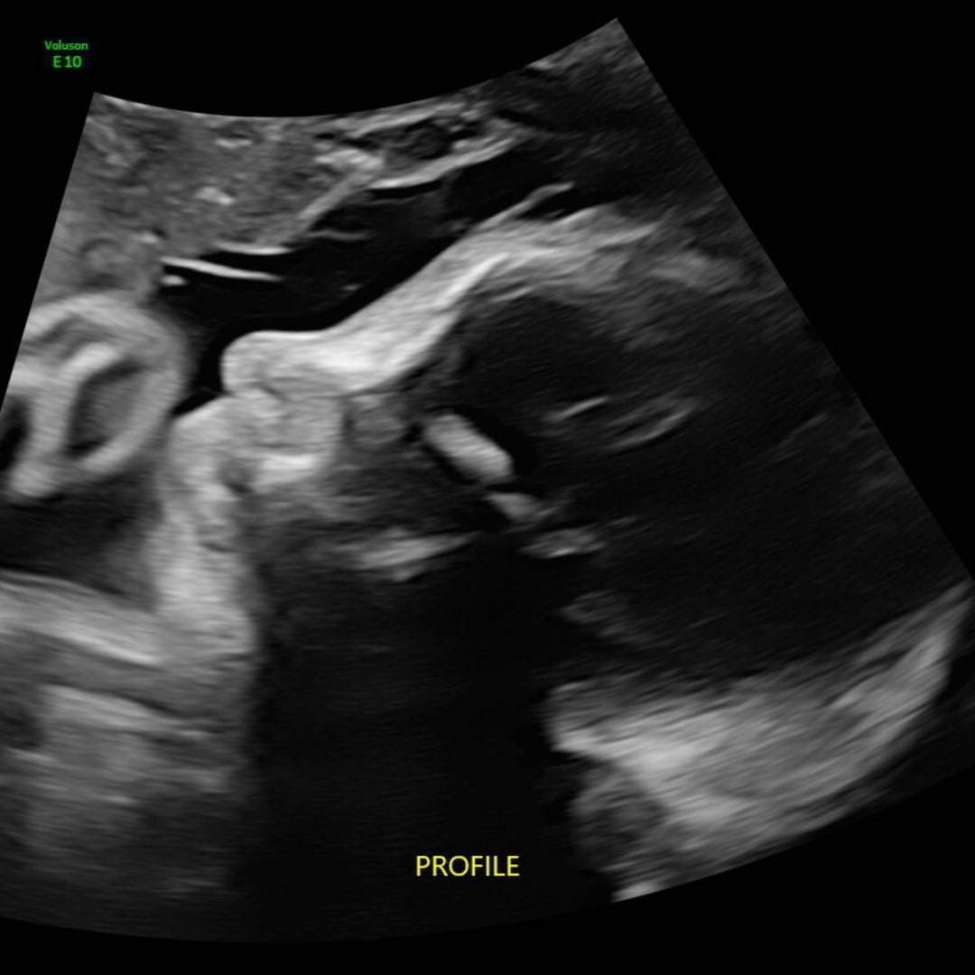 Photo shared by Emma for their Babylist baby registry.