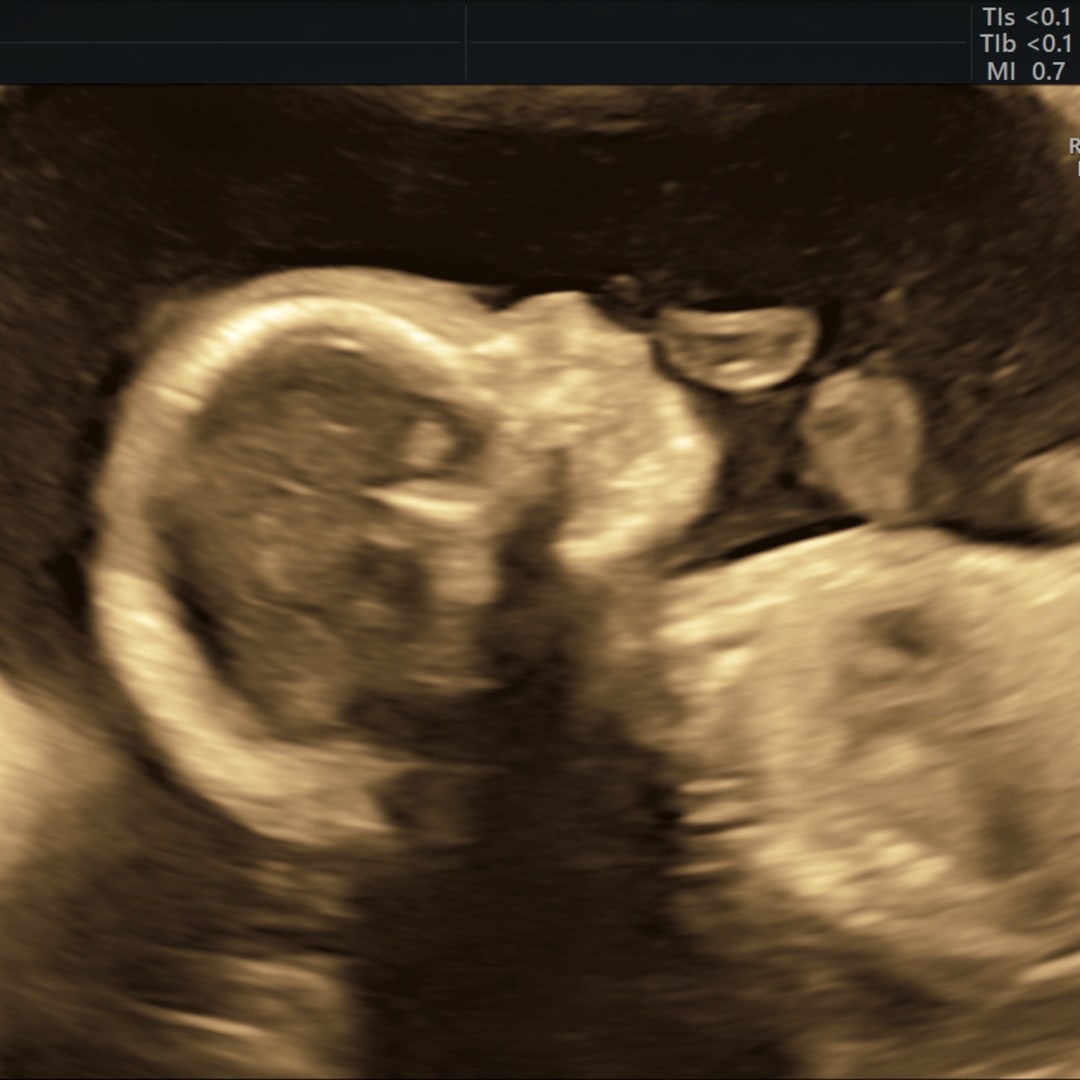 Photo shared by Amy for their Babylist baby registry.