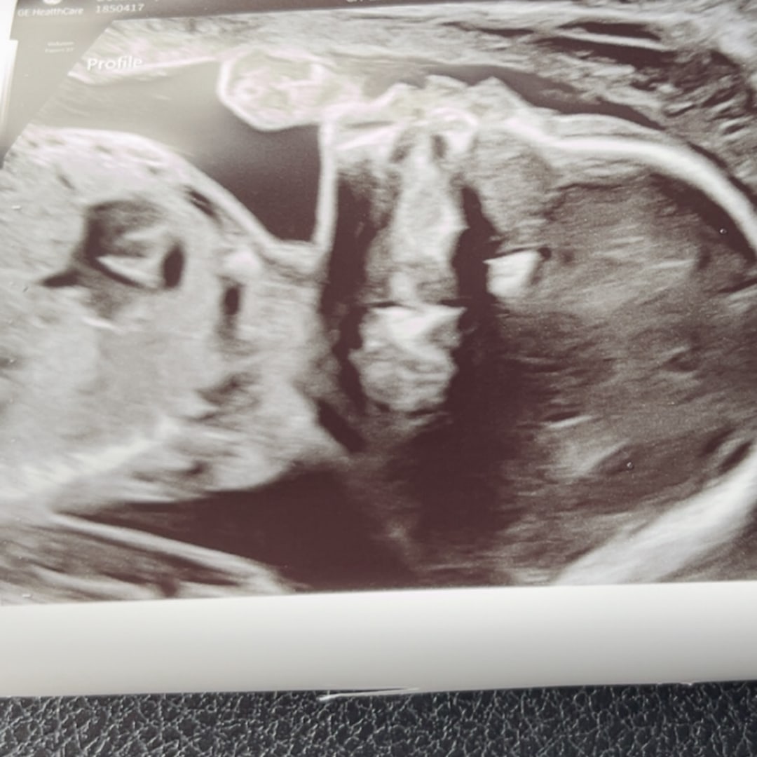Photo shared by Meagan for their Babylist baby registry.