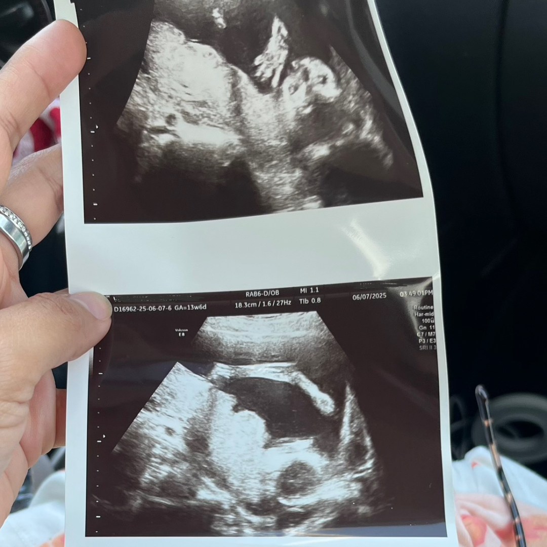 Photo shared by Shacty for their Babylist baby registry.