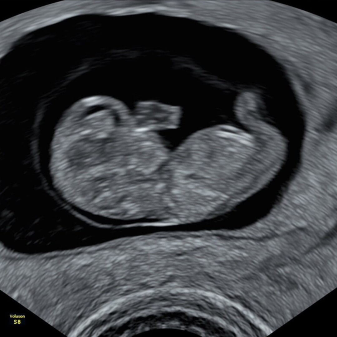 Photo shared by Ashley for their Babylist baby registry.
