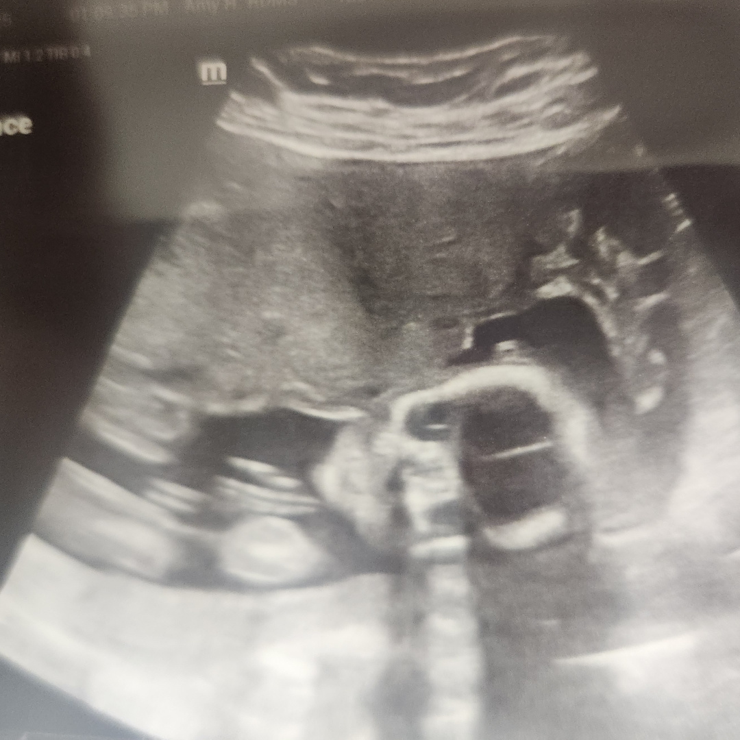 Photo shared by Natasha for their Babylist baby registry.