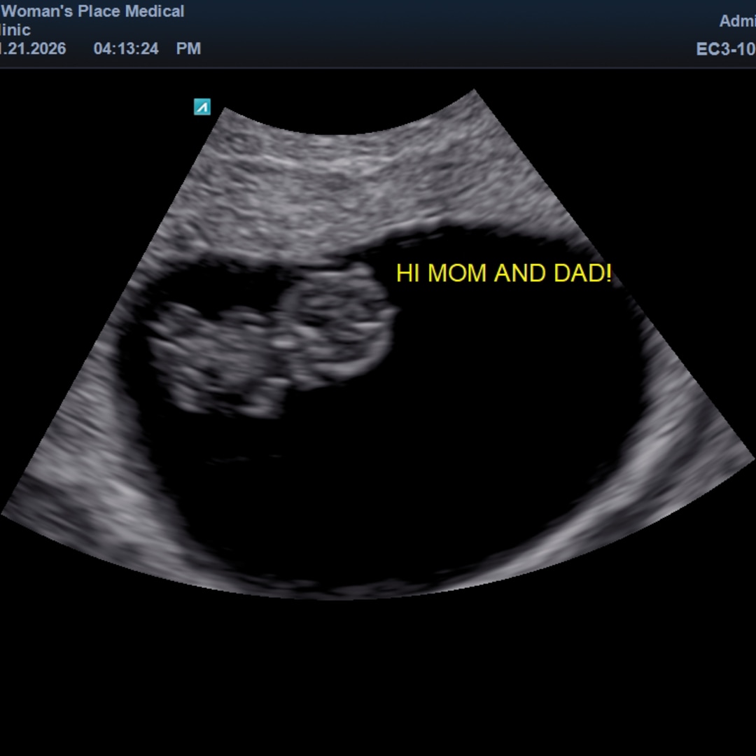 Photo shared by Ashley for their Babylist baby registry.