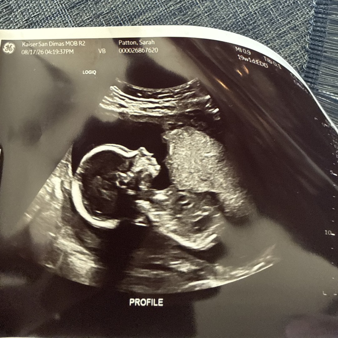 Photo shared by Sarah for their Babylist baby registry.