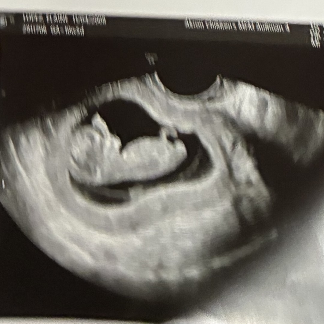 Photo shared by Elaine for their Babylist baby registry.