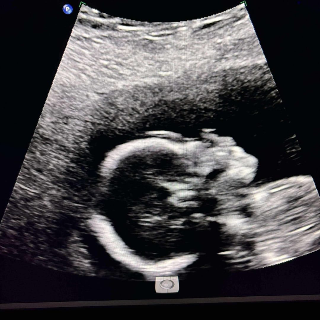 Photo shared by Amy for their Babylist baby registry.