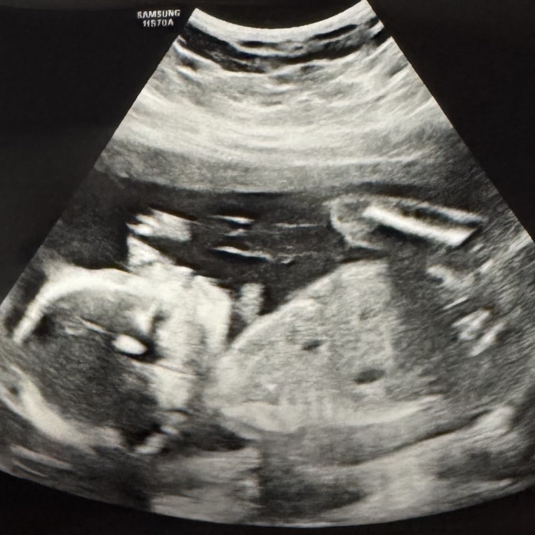 Photo shared by Madison for their Babylist baby registry.