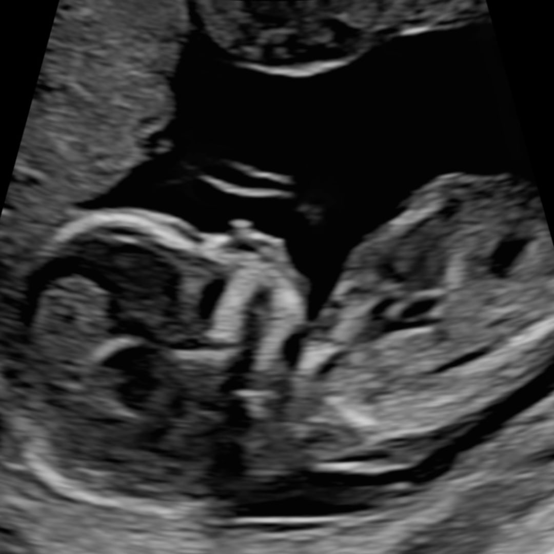 Photo shared by Kaylee for their Babylist baby registry.