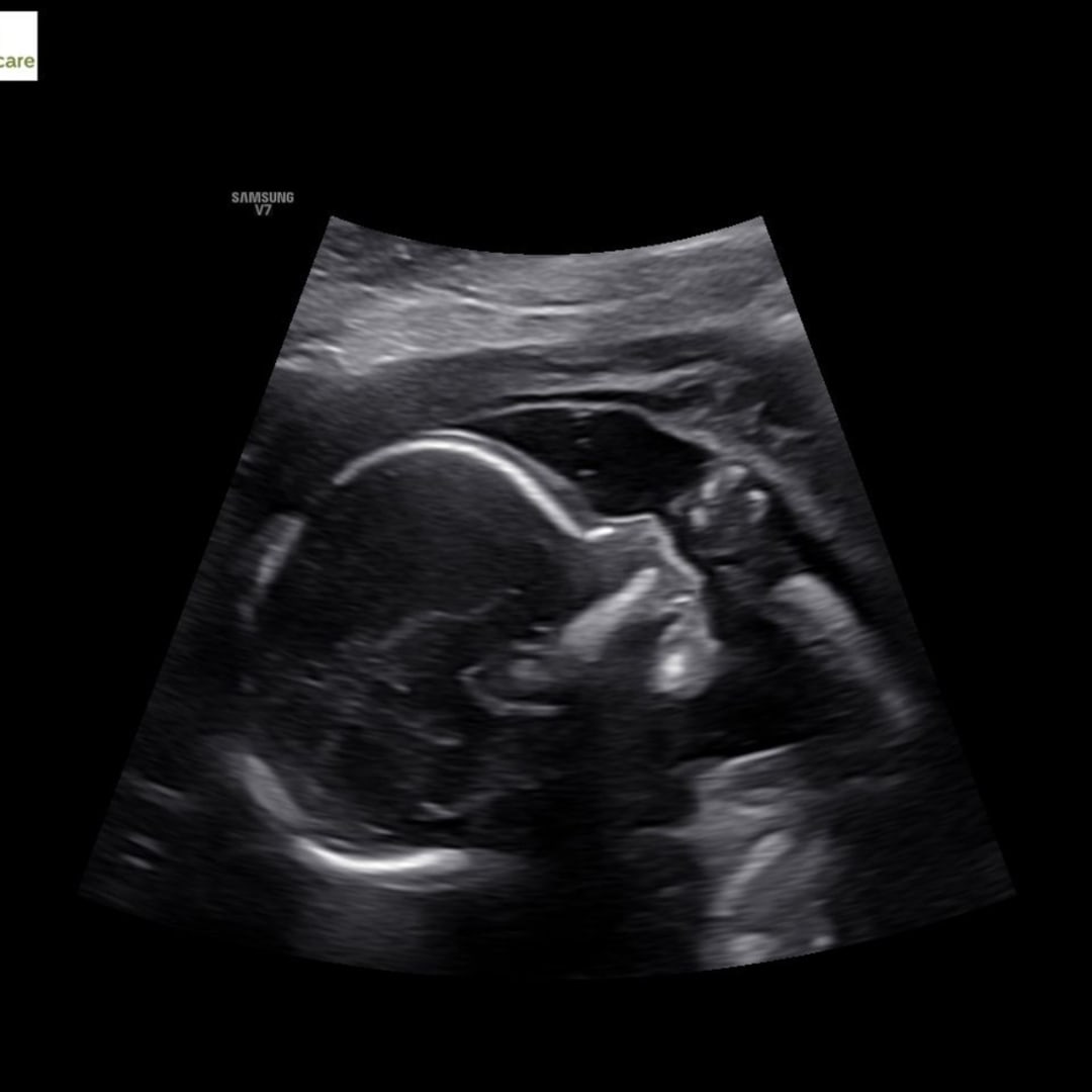 Photo shared by Samantha for their Babylist baby registry.