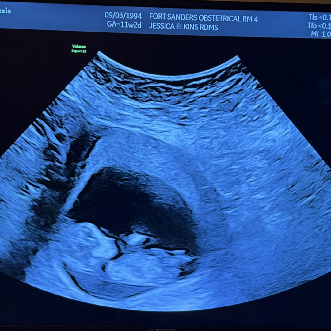 Photo shared by Alexis for their Babylist baby registry.