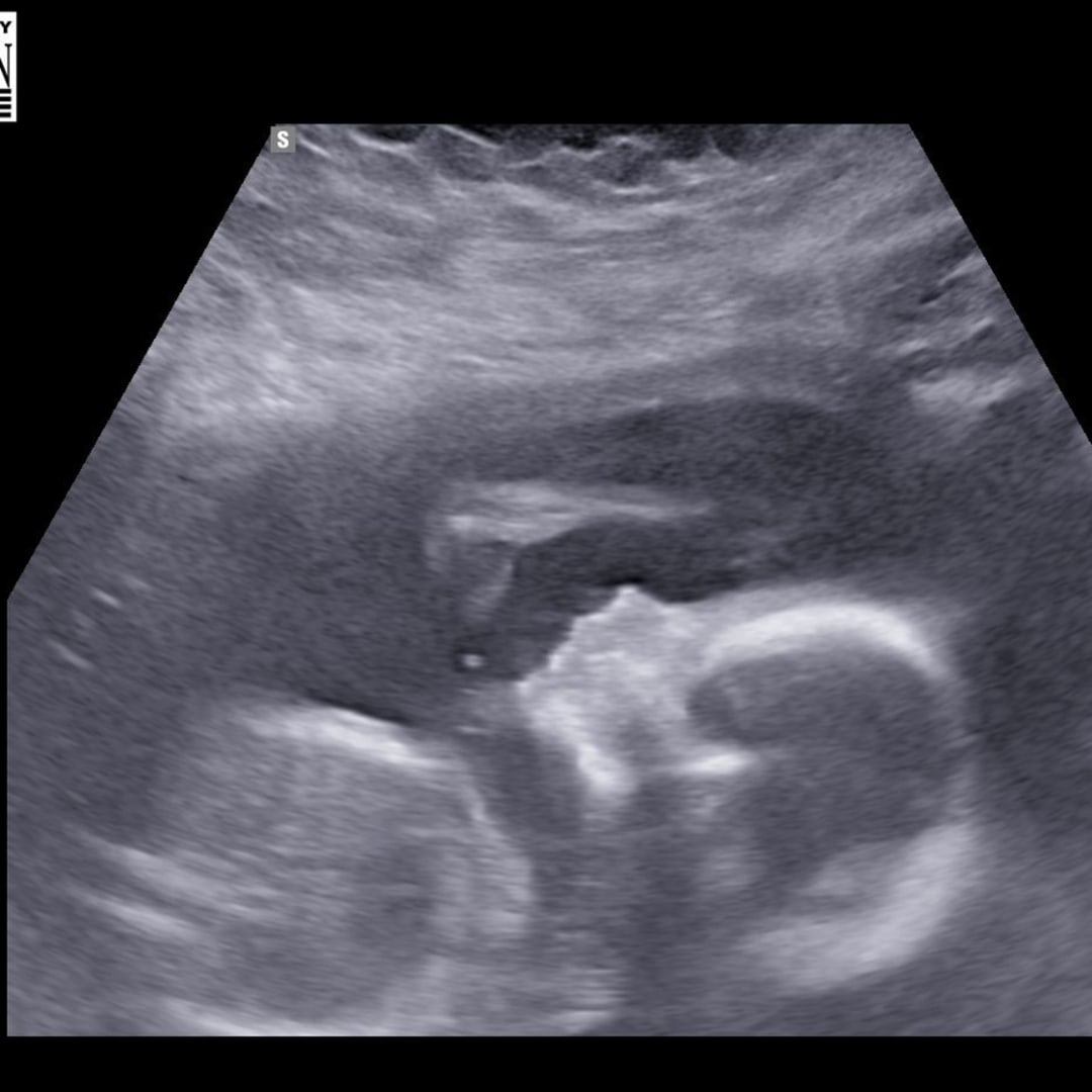 Photo shared by Caroline for their Babylist baby registry.