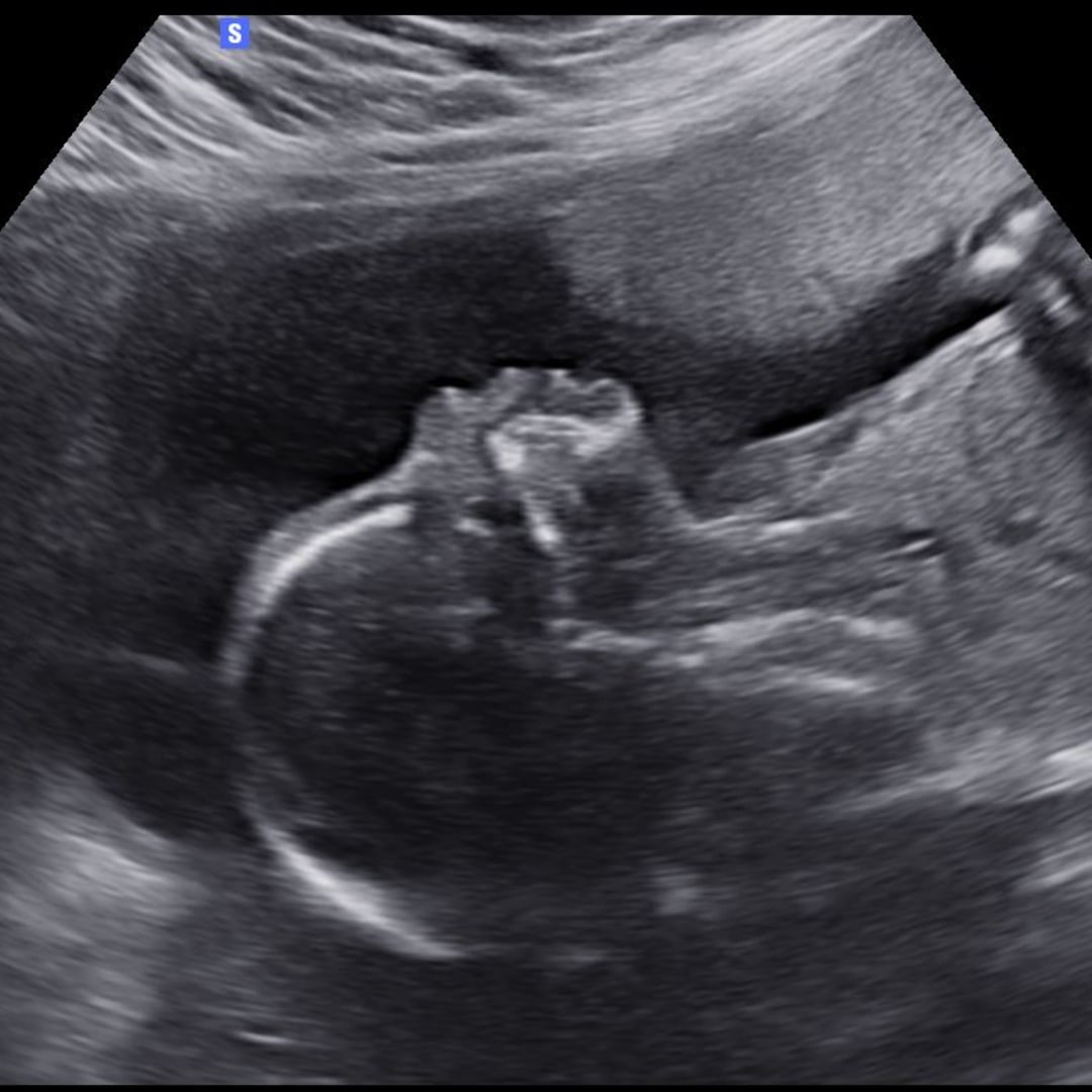 Photo shared by Jade for their Babylist baby registry.