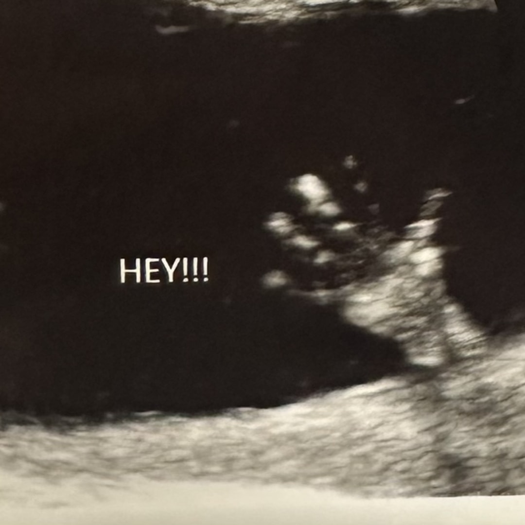 Photo shared by Janece for their Babylist baby registry.