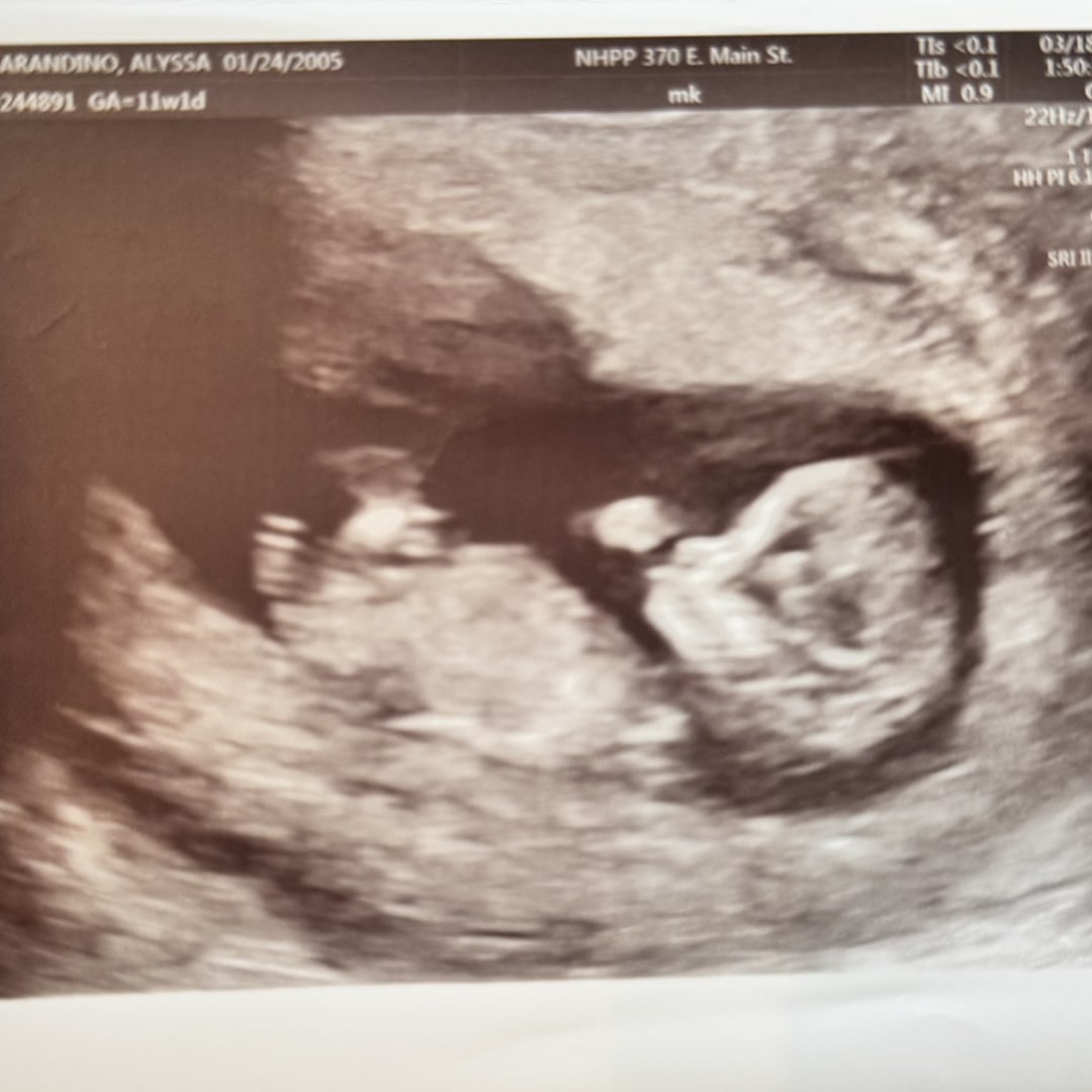 Photo shared by Alyssa for their Babylist baby registry.