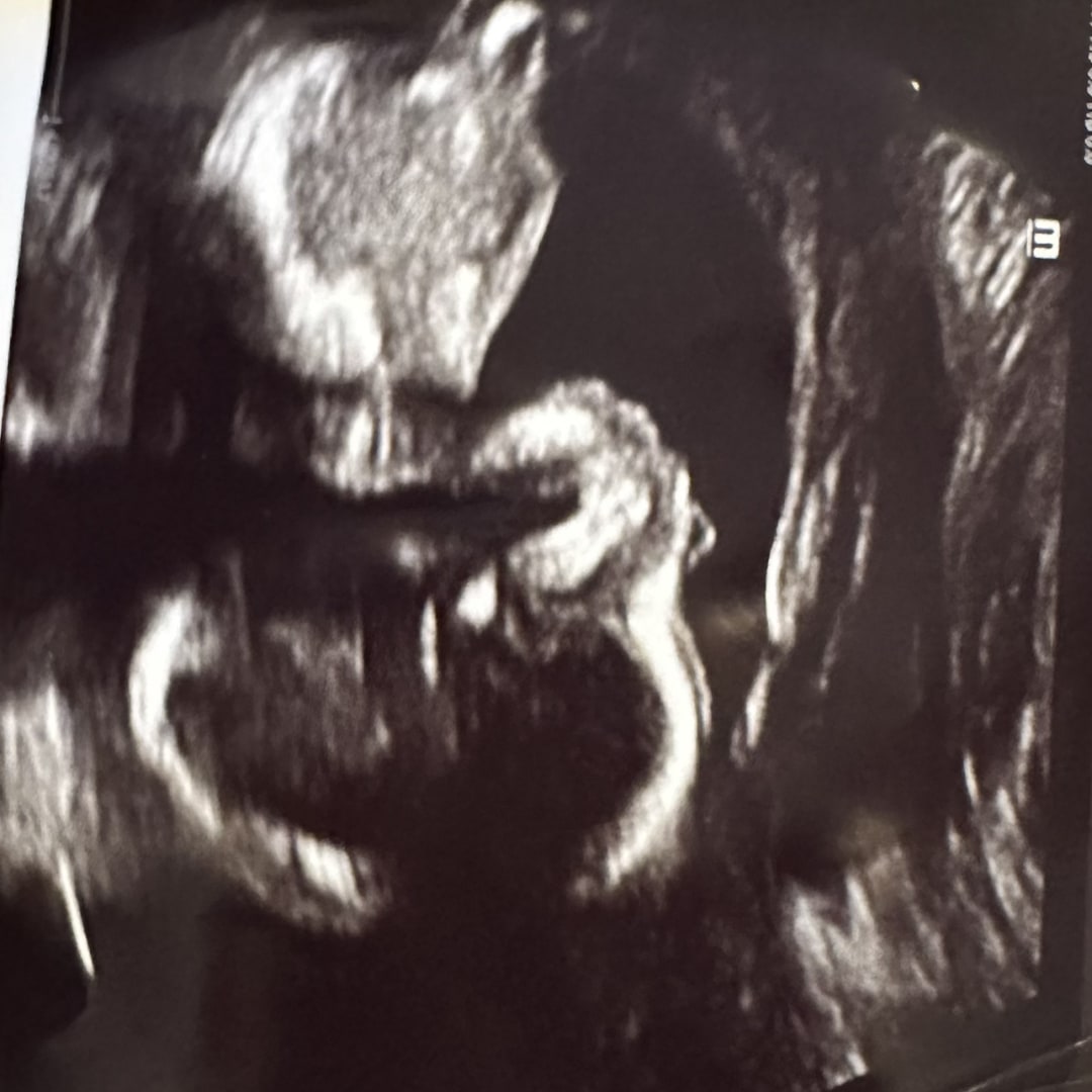 Photo shared by Shanelle for their Babylist baby registry.