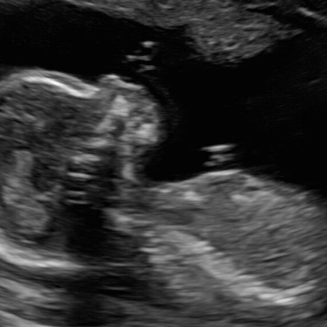 Photo shared by Carmen for their Babylist baby registry.