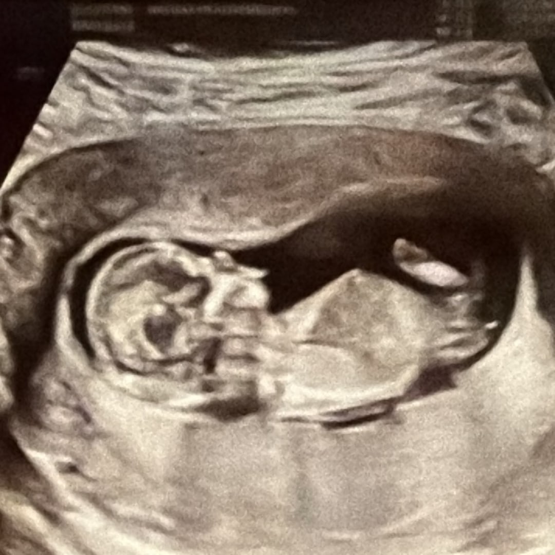 Photo shared by Heather for their Babylist baby registry.