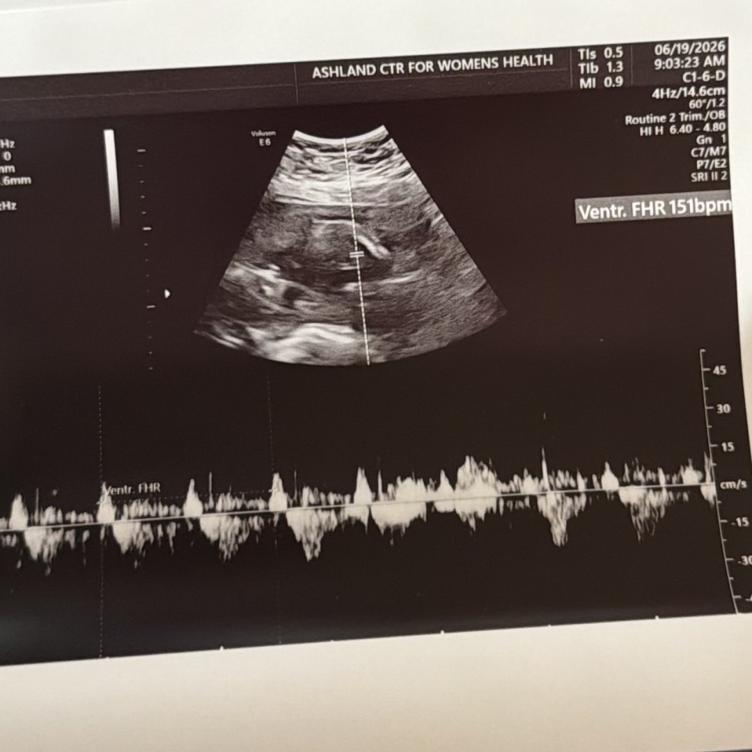 Photo shared by Dakotah for their Babylist baby registry.