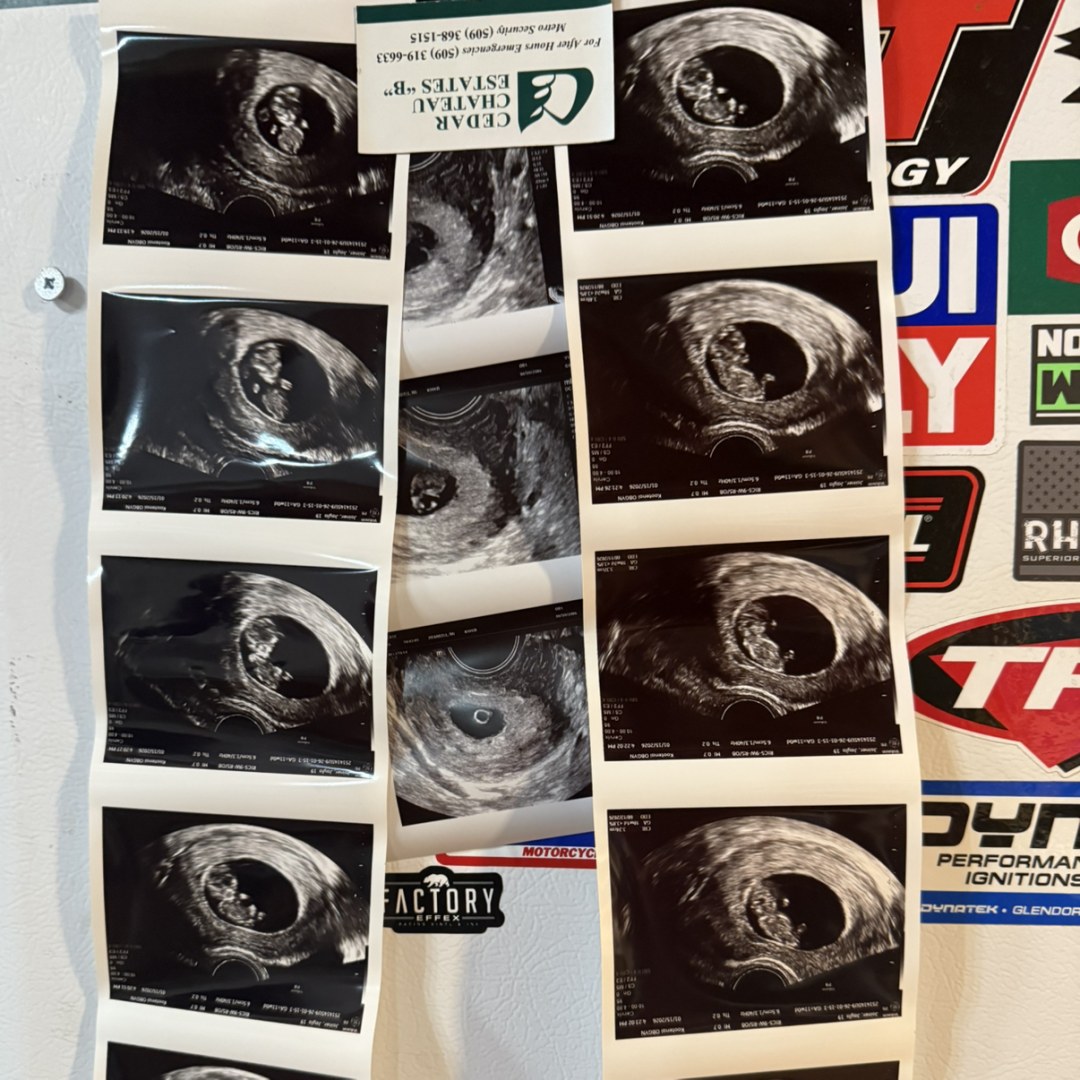 Photo shared by Jayla for their Babylist baby registry.