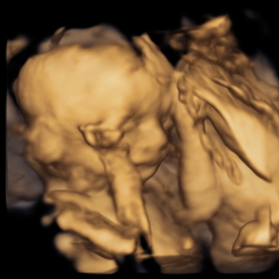 Photo shared by Dakota Star for their Babylist baby registry.