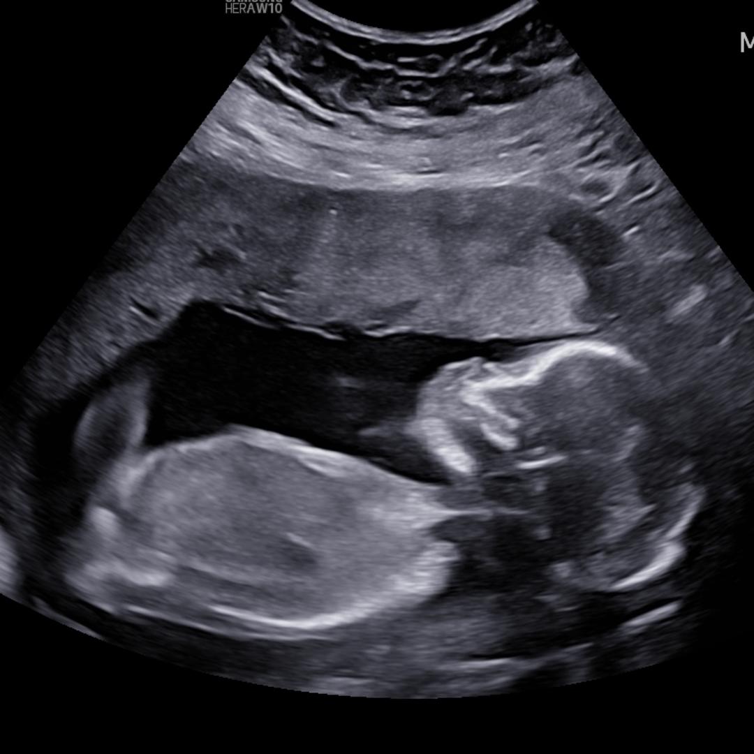 Photo shared by Nokia for their Babylist baby registry.
