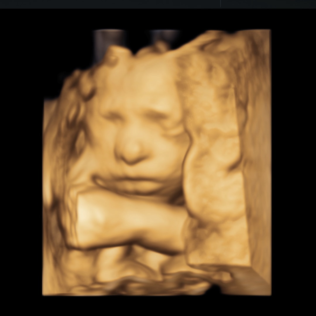 Photo shared by Arianna for their Babylist baby registry.