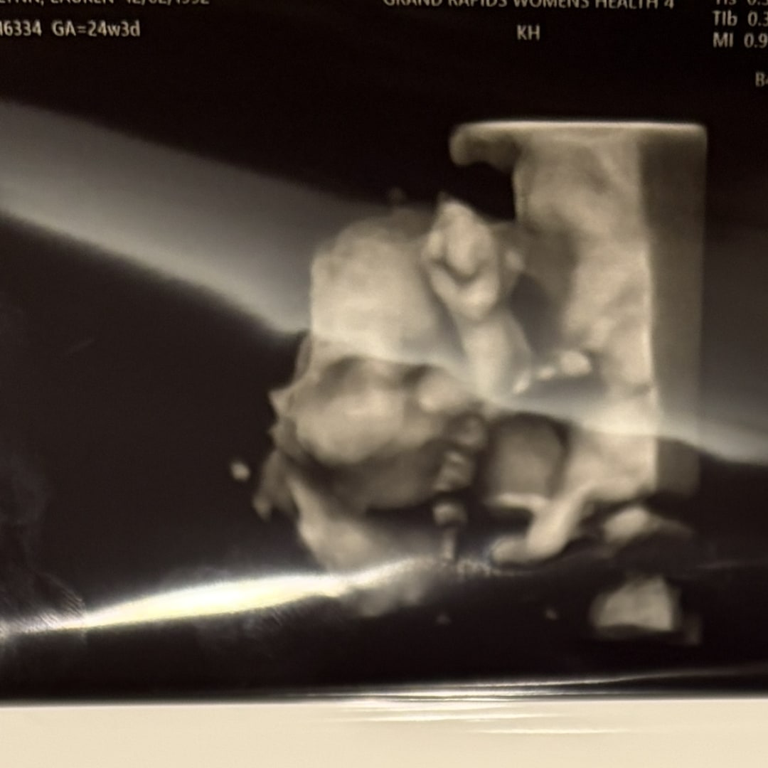 Photo shared by Lauren for their Babylist baby registry.