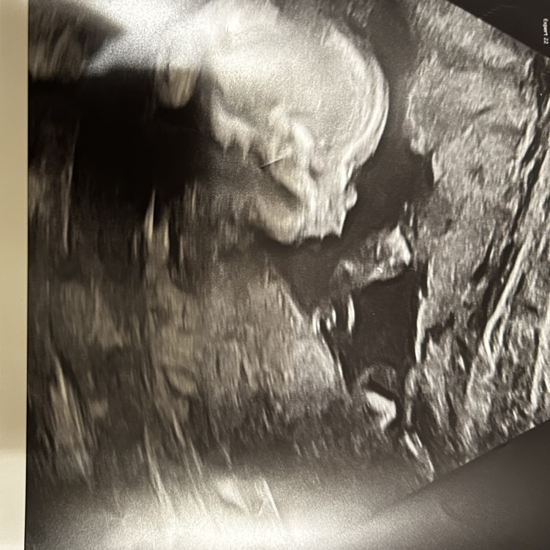 Photo shared by Dah’Marria for their Babylist baby registry.